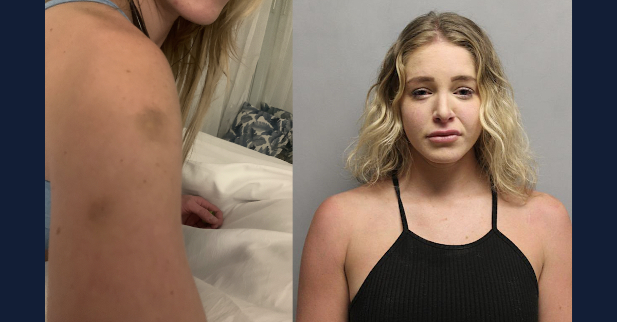 Bruises on Courtneny Clenney's upper arm (L) and Courtney Clenney in a mugshot (R)