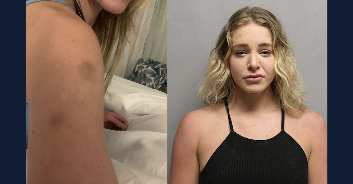 Photos of Model Courtney Clenney Show Bruises