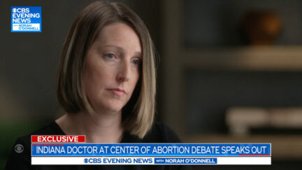 Dr. Caitlin Bernard, with shoulder-length dark blond hair parted on the right side, is seen listening to a question during an interview with CBS News.