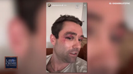 Adam Klotz recounts a subway group beating that left him injured over the weekend
